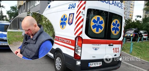 У Києві уродженці Донецька на BMW побили ветерана АТО: з’ясувалися нові деталі нападу